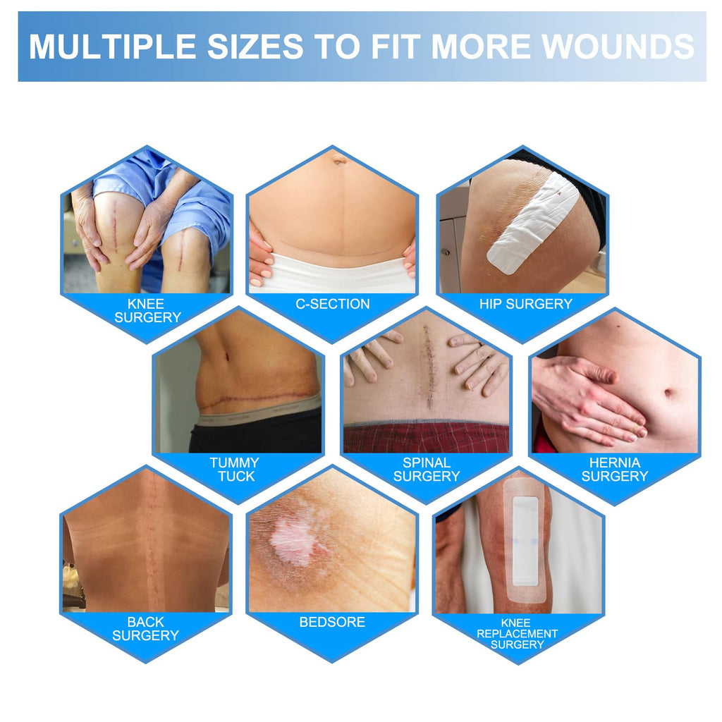 30 Pack 6"x10" Waterproof Adhesive Island Dressing for Post-Surgery Recovery | Sterile Bordered Gauze Bandages with Non-Stick Pad for Knee/Hip Replacement, Surgical Incision Care & Shower Protection