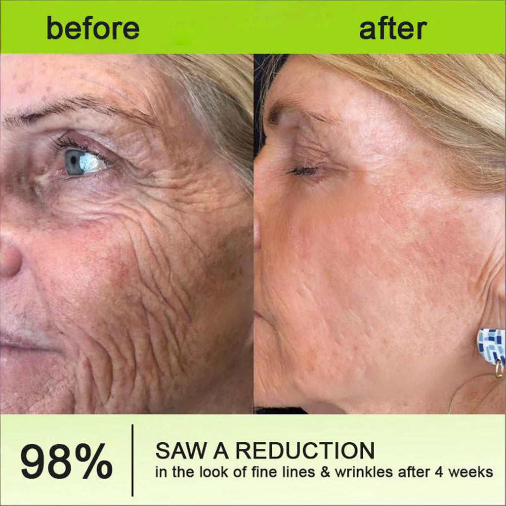 Rolimey Botoxmix & Vita-A Retinol Shot Wrinkle-Lift Tightening Cream, Advanced Retinol Body Lotion, Anti Wrinkle Cream - Natural Pore Minimizer, Wrinkles & Fine Lines for All Skin (2 Bottle)