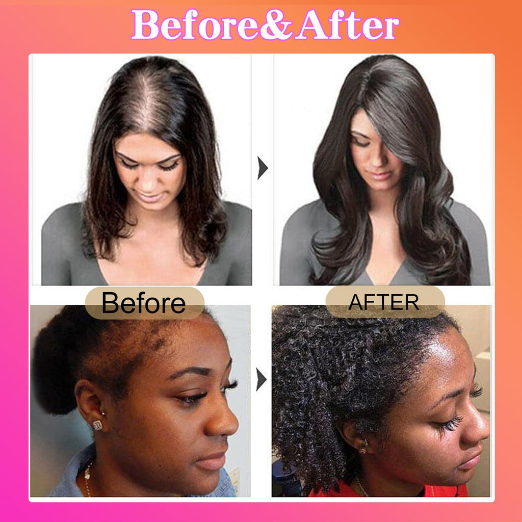 NEWUREHO 2 Bottles Batana Oil for Hair Growth, 100% Unrefined Natural Batana Oil Revitalized Hair Strength, Organic Raw Batana Conditioner For Men and Women