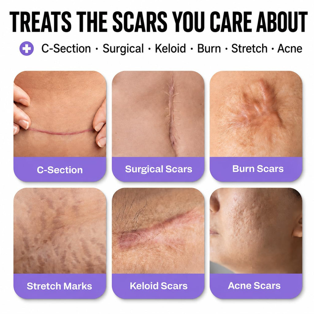 Silicone Scar Tape — Medical-Grade, 1.6" x 60", Cut-to-Fit for C-Section, Surgical & Keloid Scars, Face & Wrinkles | Reusable