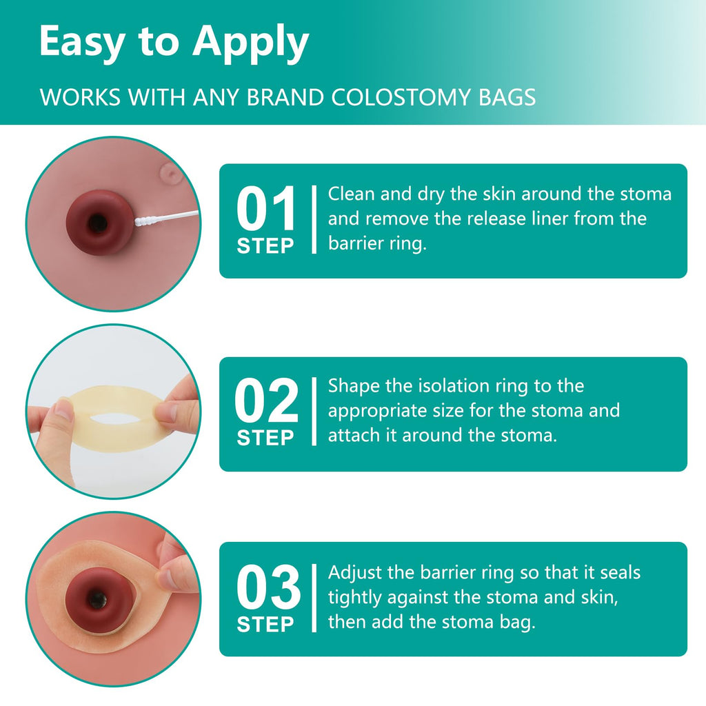 Ostomy Barrier Rings - Outer Diameter 2" (50mm) 2mm Thickness,Moldable Ostomy Rings,Hydrocolloid Skin Extender Rings for Colostomy Bags,10 Count