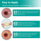 Ostomy Barrier Rings - Outer Diameter 2" (50mm) 2mm Thickness,Moldable Ostomy Rings,Hydrocolloid Skin Extender Rings for Colostomy Bags,10 Count