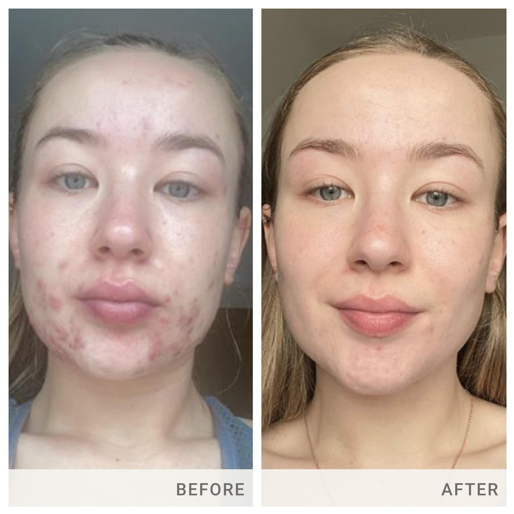 jane iredale Advanced Nutrition Programme Skin Accumax Supplement distributed by jane iredale, 60-day supply