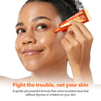 APRILSKIN Carrotene IPMP™ Clearing Solution || Quickly soothes troubled areas and helps clear blemishes | Formulated with BHA, AHA, Niacinamide & Zinc Oxide | Vegan, Cruelty-Free (0.67fl.oz.)