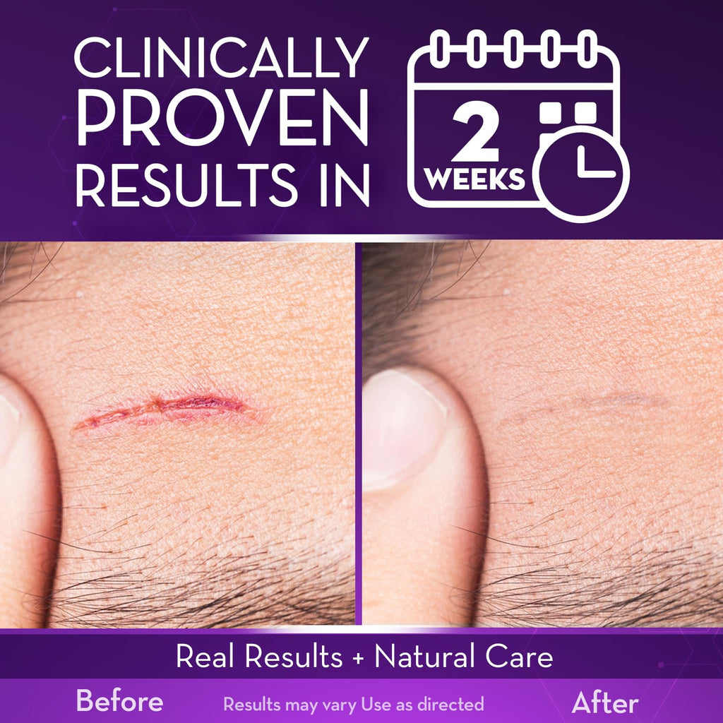 Cicatricure Advanced Scar Gel for Face & Body - Proven Results in 2 Weeks, Scar Treatment for Surgical Scars, Stretch Marks, Scars of Burns and Injuries, Acne Scar Treatment, 1 oz (28 g) - Pack of 3