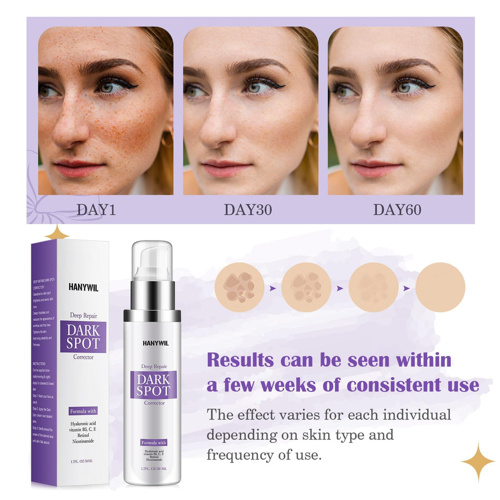 HANYWIL Dark Spot Remover for Face & Body Serum with Retinol & Niacinamide - Corrects Melasma, Sun & Age Spots, Hyperpigmentation Treatment for All Skin, Dermatologist Tested (1.7 Fl Oz)