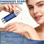 Rvlaim 100% Silicone Scar Gel Scar Cream, Advanced Silicone Gel for Removal of Surgical, Burns, Acne Scar, Old and Recent Scars and Stretch Marks, 1.7 oz/50ml