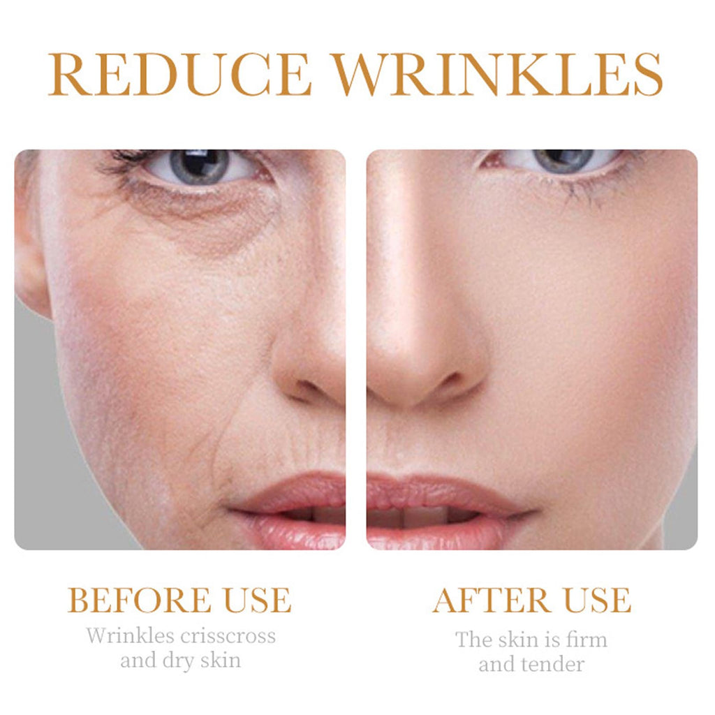 Collagen Skin Care Set, 6Pcs Anti Aging Face Care Sets for Women, Firming Skin, Shrink Pores, Smooth Wrinkles, Hydrating Skin Care Set Include Serum Face Cream Eye Cream Toner Cleanser Facial Mask1