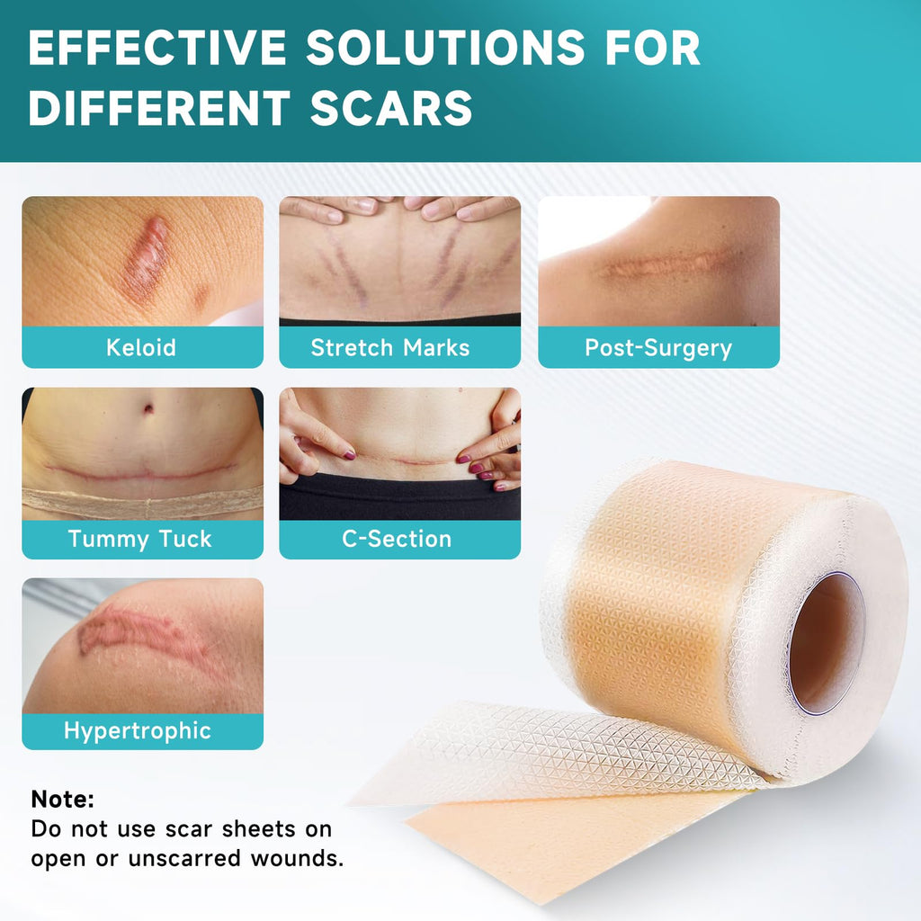 Pumkot Silicone Scar Sheets, Silicone Scar Tape(1.8” x 157” Roll-4M), Medical Grade Scar Removal Away Strips for Surgical Scars, Keloid, C-Section, Burn - Stickiness Upgrade, Waterproof, Reusable