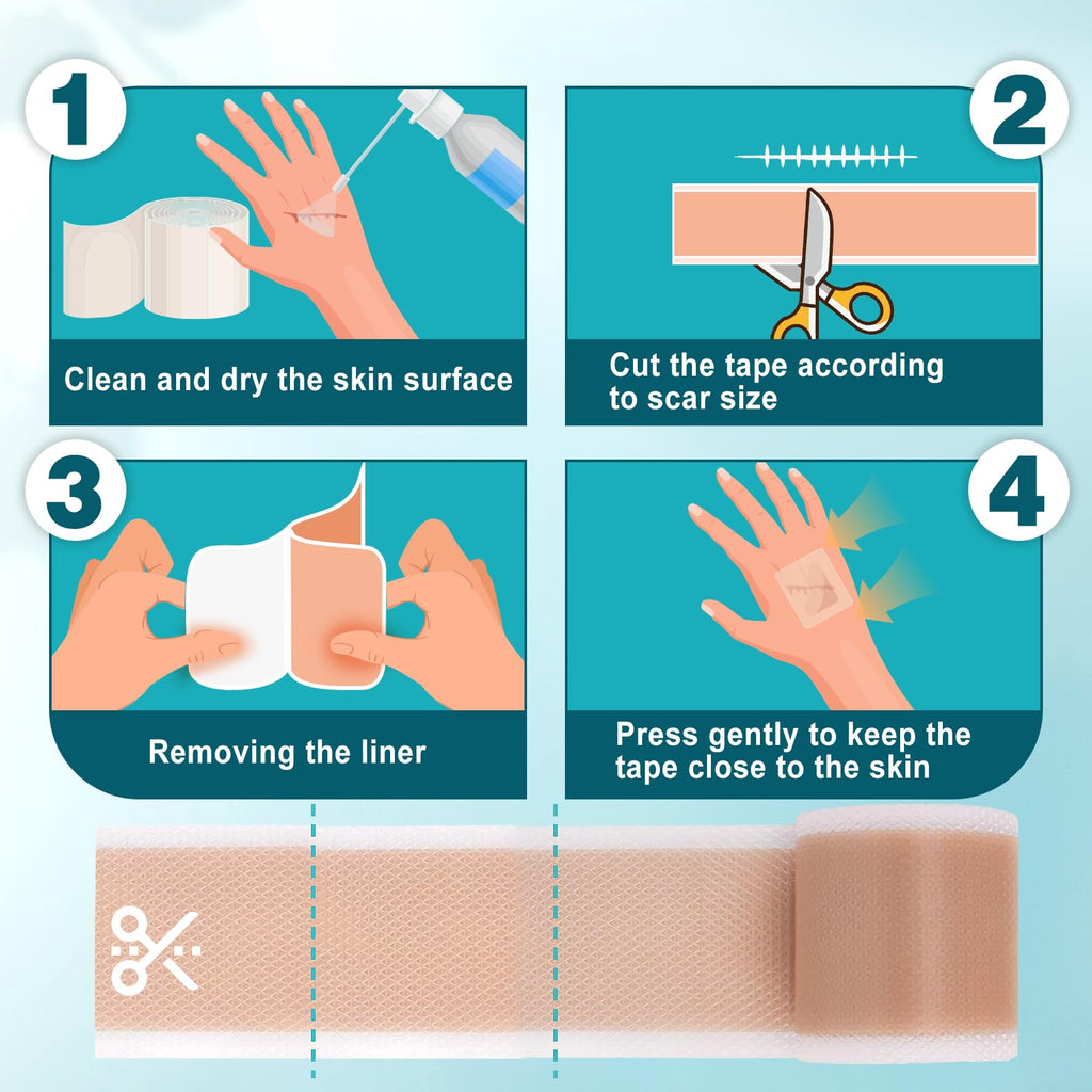 Arme Silicone Scar Tape, 1.6"x480" Silicone Scar Sheets(4 Rolls-12M) Medical Grade Scar Tape for Surgical Scars, Reusable Scar Patches, Professional Scar Removal Strips for C-Section Keloid Tummy Tuck