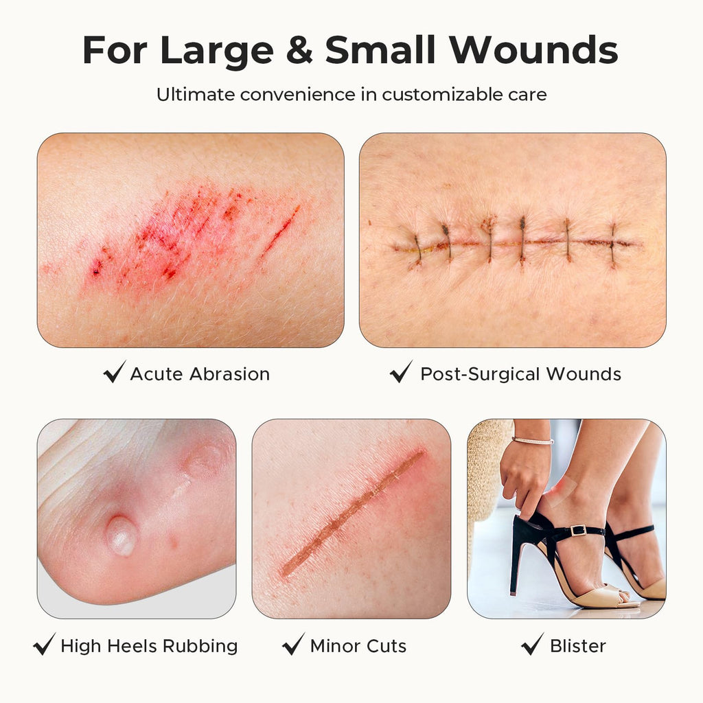 TKTK Hydrocolloid Roll 2 Sizes, Cut-to-Fit Bandages for Pimple & Wounds