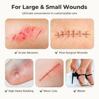 TKTK Hydrocolloid Roll 2 Sizes, Cut-to-Fit Bandages for Pimple & Wounds