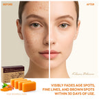 KlearBloom Kojic Acid Soap, Turmeric Soap Bar for Dark Spots Brightening & Moisturizing with Collagen, Vitamin E, Retinol, Hyaluronic Acid, Shea Butter, Paraben & Sulfate-Free 105g x4 Bars