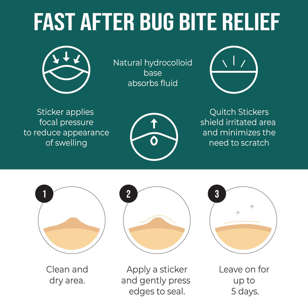 Quitch Mosquito Bite Itch Relief Patch, After Bite Insect Bite Treatment, Anti Itch Cream Alternative, Insect Bite Relief, Cruise, Travel and Camping Essential for Kids