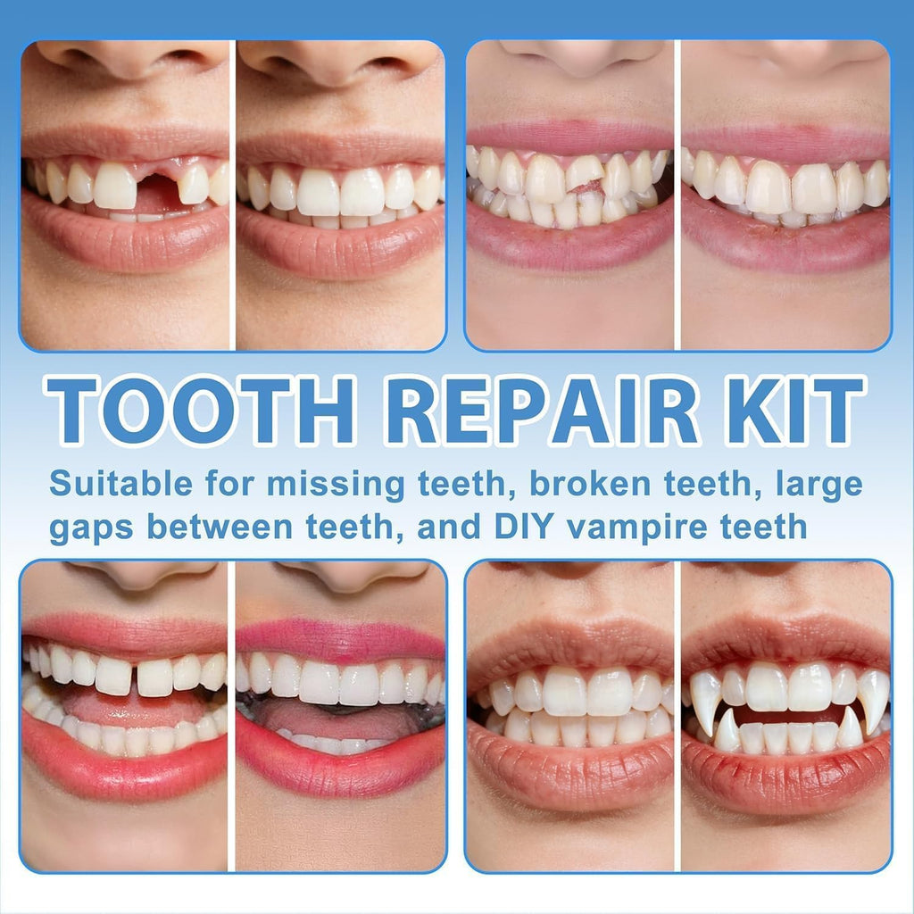 Tooth Repair Kit, Moldable False Teeth Beads for Teeth Repair, Suitable for Missing, Cracked DIY Denture Kit, 1Pack