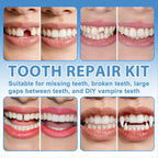 Tooth Repair Kit, Moldable False Teeth Beads for Teeth Repair, Suitable for Missing, Cracked DIY Denture Kit, 1Pack