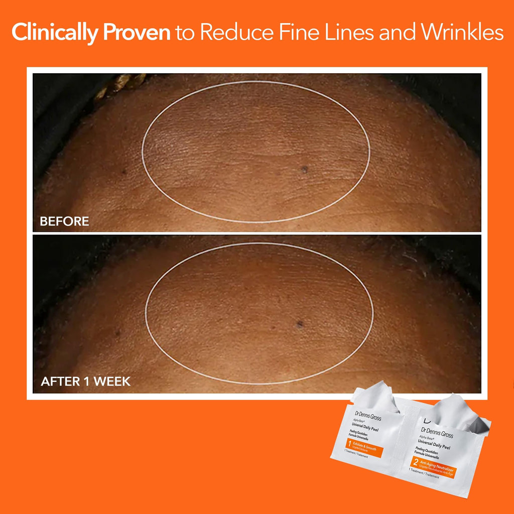 Dr Dennis Gross Alpha Beta Universal Daily Peel: for Uneven Tone or Texture and Fine Lines or Enlarged Pores, (5 Treatments)