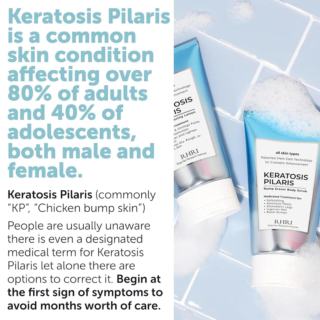 KP Bump Eraser Body Set with 10% AHA | Keratosis Pilaris Treatment | Keratosis Pilaris Lotion | Exfoliating Body Scrub | Ingrown Hair Treatment | Bundle Set for Bump, Strawberry Legs, Redness, Dryness