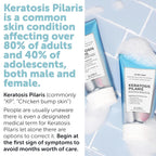 KP Bump Eraser Body Set with 10% AHA | Keratosis Pilaris Treatment | Keratosis Pilaris Lotion | Exfoliating Body Scrub | Ingrown Hair Treatment | Bundle Set for Bump, Strawberry Legs, Redness, Dryness