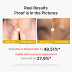 medicube Body Peel Shot with Kojic Acid and Turmeric
