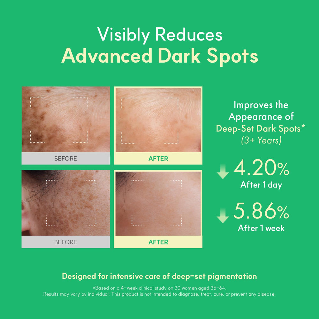 Easydew DW-EGF Melatoning Ampoule 5X - Hydrating Dark Spot Serum with Niacinamide & Glutathione for Uneven Skin - Fast Absorbing Day & Night Ampoule Korean Skin Care (Pump 0.27 fl oz, EGF 5X)