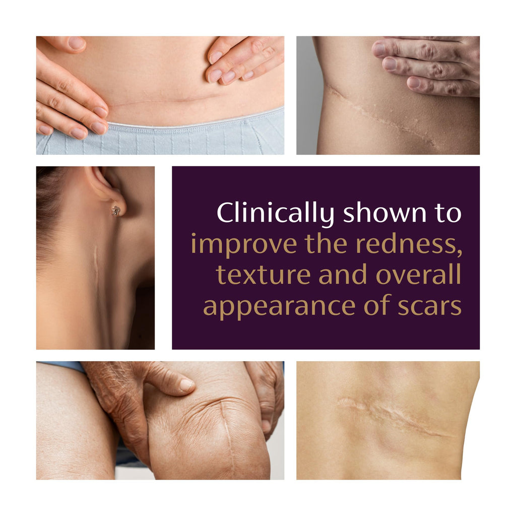Mederma Advanced Scar Gel, Cepalin Scar Treatment, Old and New Scars, 20g