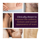 Mederma Advanced Scar Gel, Cepalin Scar Treatment, Old and New Scars, 20g