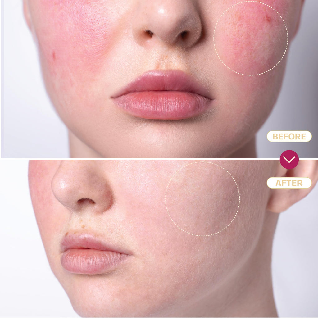 "BASE LABORATORIES Hypochlorous Acid Spray for Skin & Face | Healing HOCL Molecule Spray | for Wounds, Irritations, Redness, Facial Cleanser, Acne & Eczema Treatment | 240ml"