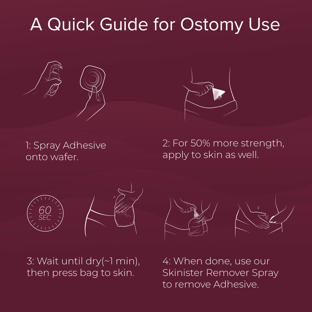 Skinister Medical Adhesive Spray | Silicone Skin Glue for Ostomy Bags, Breast Forms, Condom Catheters, Prosthetics, SFX | 4oz