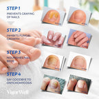 Toenail Fungus Treatment Extra Strength - Nail Fungus Treatment For Toenail Extra Strength - Nighttime Nail Patches & Nail Treatment Liquid Set (32patches+15ml)