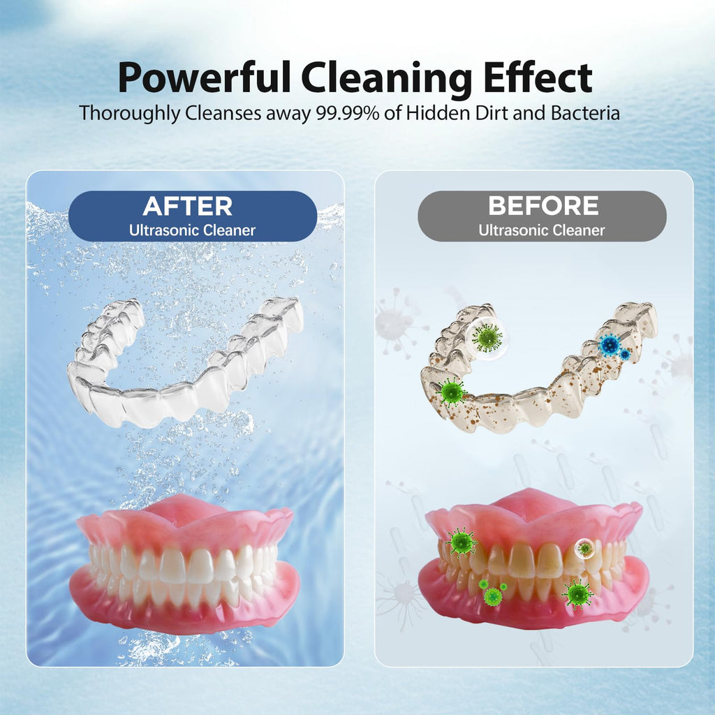 Hiwill Ultrasonic Cleaner For Retainer Cleaning Machine: 43000Hz Sonic Dental Clean Pod For Denture Mouthguard