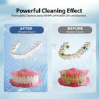 Hiwill Ultrasonic Cleaner For Retainer Cleaning Machine: 43000Hz Sonic Dental Clean Pod For Denture Mouthguard