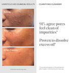 Murad Acne Control Clarifying Cleanser – Salicylic Acid & Green Tea Formula for Acne, Deep Pore Cleansing, Oil Control & Breakout Prevention for Clear, Balanced, Healthy-Looking Skin 16.9 Fl Oz