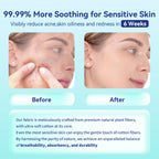 Ditoi Disposable Face Towels XL, Soft Cotton Facial Cleansing Cloths, Dry Face Towelettes for Makeup Removal, Sensitive Skin & Daily Skin Care,10"×12",100 Count