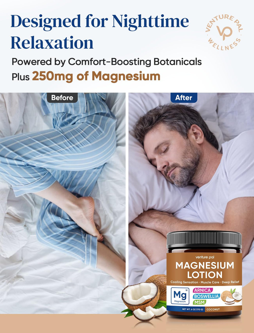 Magnesium Lotion with Arnica, MSM & Boswellia – Cooling Comfort & Relaxation, Magnesium Cream for Muscles & Joints – Ideal for Legs or Feet - Safe for Kids – 6 fl oz