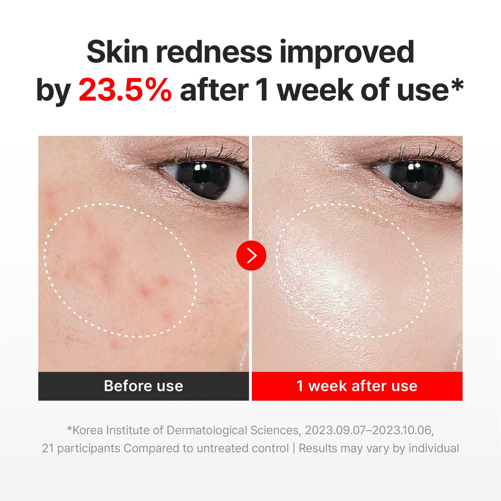 CENTELLIAN 24 Madeca Cream Time Reverse (1.69fl oz) - Advanced Fast-Absorbing & Nourishing, Hydrates, Firms & Reduces Wrinkles, Low Irritation, Korean Skin Care Centella Asiatica, Collagen