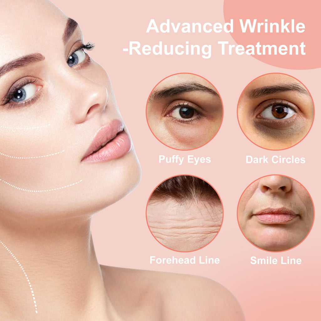 YLOTRE Novalift Micro Eye Patches, Under Eye Patches for Puffy Eyes, Dark Circles & Fine Lines, Deeply Hydrating Anti-Wrinkle Patches, Smooth Application Forehead & Smile Line Patches (2)