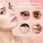 YLOTRE Novalift Micro Eye Patches, Under Eye Patches for Puffy Eyes, Dark Circles & Fine Lines, Deeply Hydrating Anti-Wrinkle Patches, Smooth Application Forehead & Smile Line Patches (2)