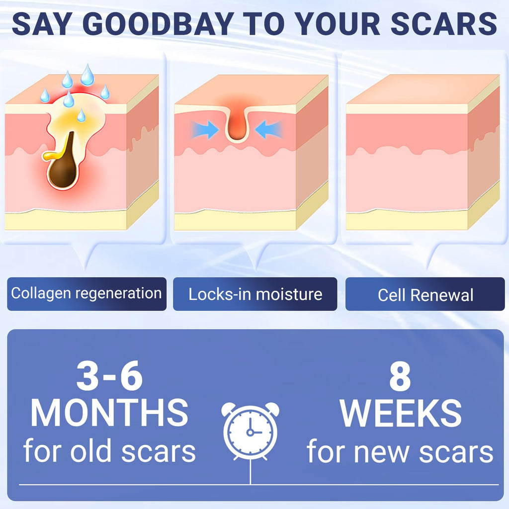 Kunyle Scar Cream, Silicone Scar Gel, Advanced Scar Removal Cream for Surgical Scars, Stretch Marks Removal, Keloid Bump Removal, Old and New Scars 2.11 Oz (60g)