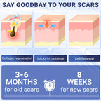Kunyle Scar Cream, Silicone Scar Gel, Advanced Scar Removal Cream for Surgical Scars, Stretch Marks Removal, Keloid Bump Removal, Old and New Scars 2.11 Oz (60g)