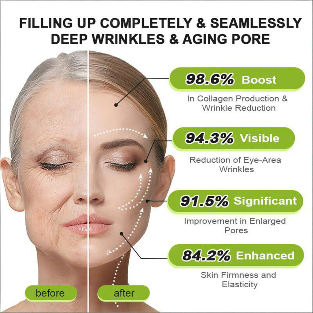 Rolimey Botoxmix & Vita-A Retinol Shot Wrinkle-Lift Tightening Cream, Advanced Retinol Body Lotion, Anti Wrinkle Cream - Natural Pore Minimizer, Wrinkles & Fine Lines for All Skin (2 Bottle)