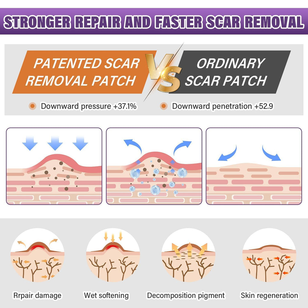 Silicone Scar Sheets,Silicone Scar Tape,Silicone Scar Removal Strips for Surgical,C-Section,Tummy Tuck,Keloid Scars (1.6"X 157" Roll-4M) Keloid Bump Removal