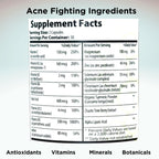 Clear Skin Acne Vitamins Capsules | Complexion Supplements with Pantothenic Acid B5, Zinc Picolinate, Vitex Chasteberry | 60 Count