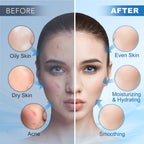 Angeland Jelly Mask for Facials Professional, Hydrating & Moisturizing Peel-Off Natural Gel Face Mask SkinCare, Professional Spa Use Jelly Face Masks, Deep Hydration & Glow 23 Fl Oz (Hyaluronic Acid)