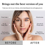 Boto Bliss Elixir Serum, Anti Wrinkle Serum, Bot-o Seru-m For Deep Wrinkles, Olavitas Bo-to Ser-um, Olivita Liquid B-oto Seru-m, Reclaim Youthful Vibrancy, Diminish Signs Of Aging(1 Pack)