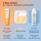 BellamiLuxx Folliculitis Acne Lotion for Body: Helps Reduce Itch, Redness, Body Acne, Bumps & Uneven Texture with Salicylic & Glycolic Acid + Botanicals - Gentle Care for Folliculitis-Prone Skin