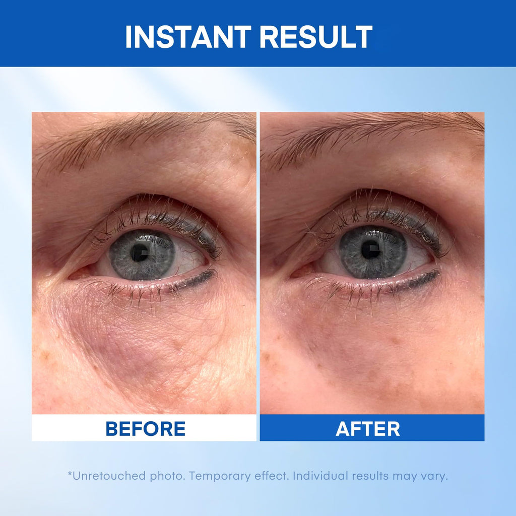 HealthyDerm Instant Under Eye Lift Serum - Reduces Eye Bags, Wrinkles, Puffy Eyes, Dark Circles & Crow’s Feet in Minutes - Advanced Firming Polysaccharide Formula for Mature Skin - 20 mL