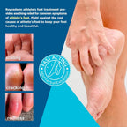 Roycederm Extra Strength Athletes Foot Treatment Cream, Powerful Relief for Itching and Burning, Suitable for Men and Women