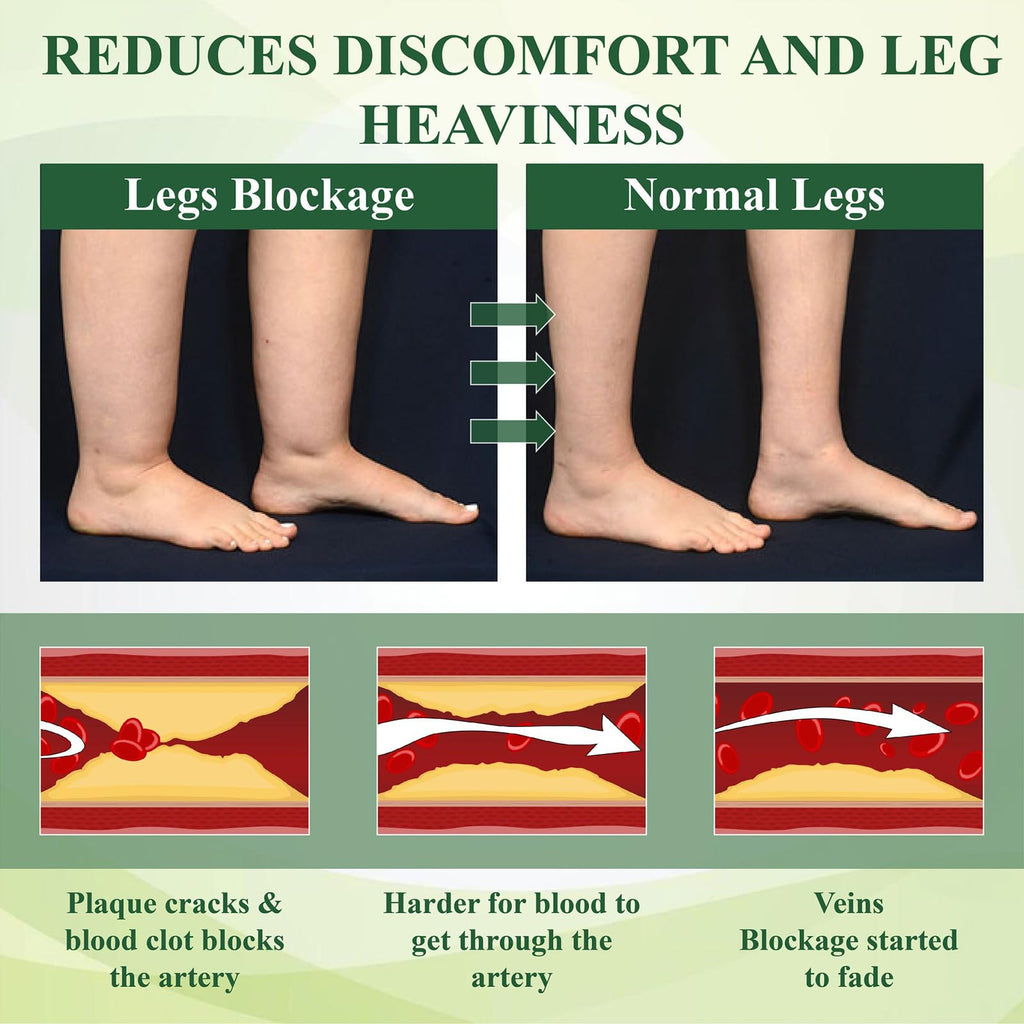 Fluidease Leg Therapy Edema Cream, Fluid Ease Leg Therapy Cream, Lymphatic Drainage Massage Cream, Swell Care Lymphatic Massage Cream, Edema Relief for Legs and Feet (1)