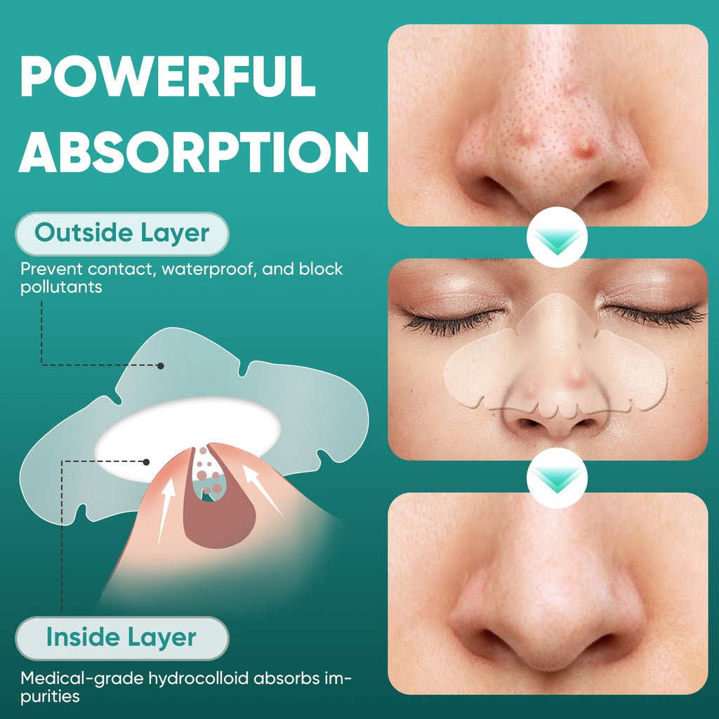 kindshine 60 Count Nose Pore Patches, Medical-Grade Hydrocolloid Pore Strips, Overnight Oil-Absorbing & Pore-Refining, Pimple Stickers to Absorb Acne Nose Gunk